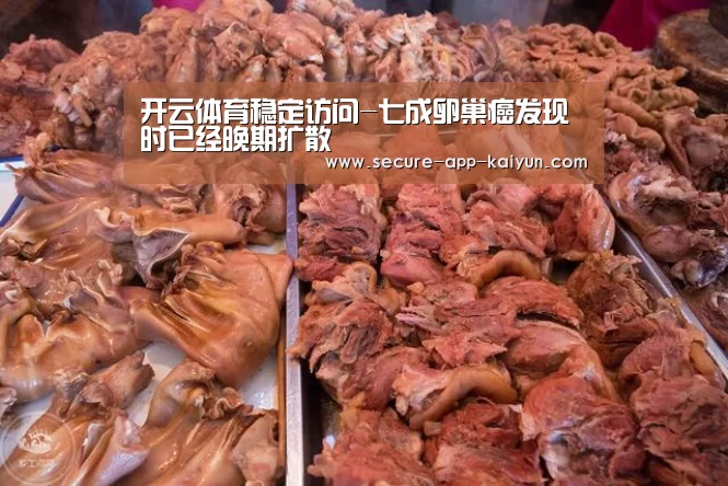 开云体育稳定访问-七成卵巢癌发现时已经晚期扩散(图2) 开云体育官方入口