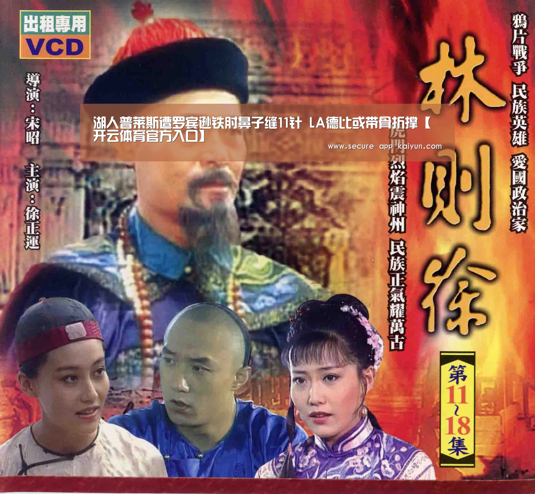 湖人普莱斯遭罗宾逊铁肘鼻子缝11针 LA德比或带骨折撑【开云体育官方入口】(图3) 开云官网首页